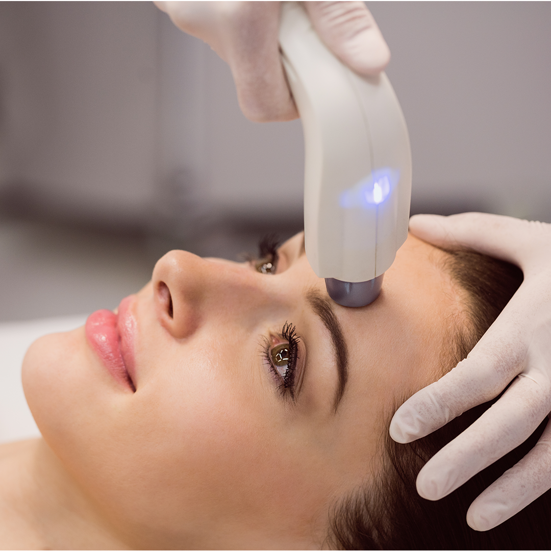 Laser Skin Resurfacing